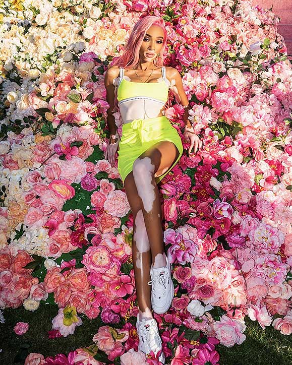 Winnie-Harlow - MEGA MEGA | All The Stylish Celebrities We Spotted At Coachella 2019